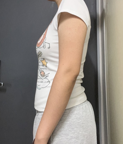 Before Image