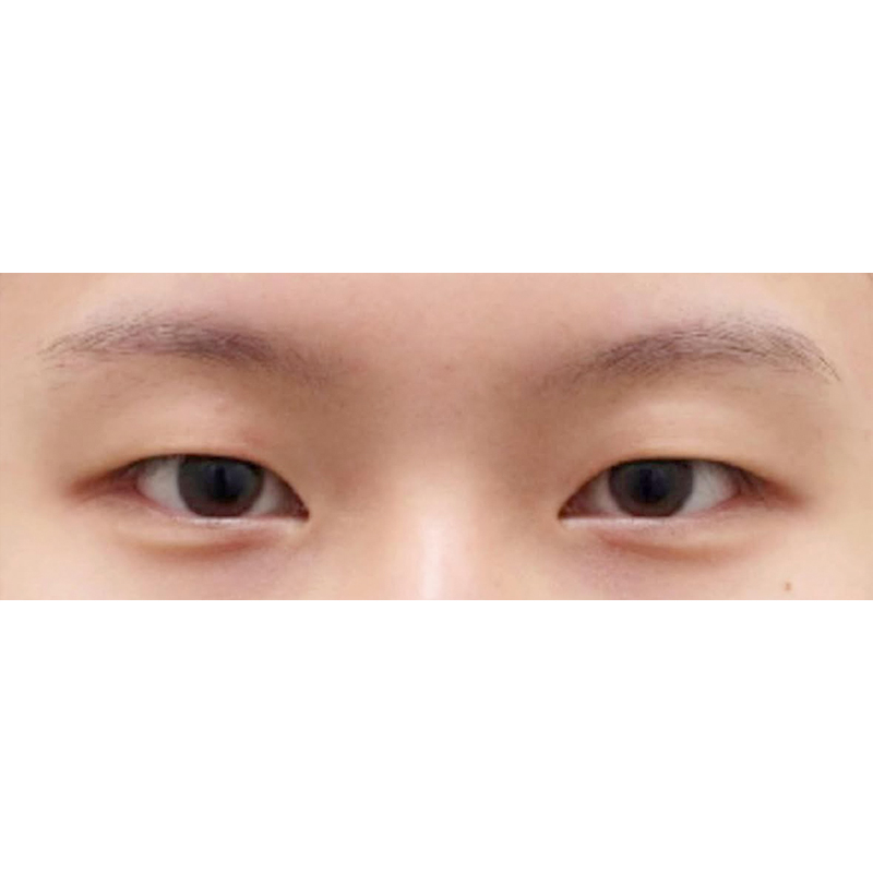 Before Image