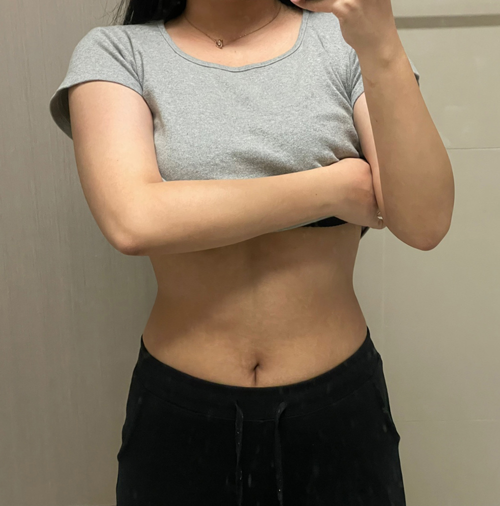 Before Image