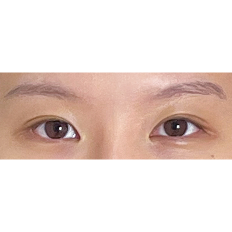 Before Image